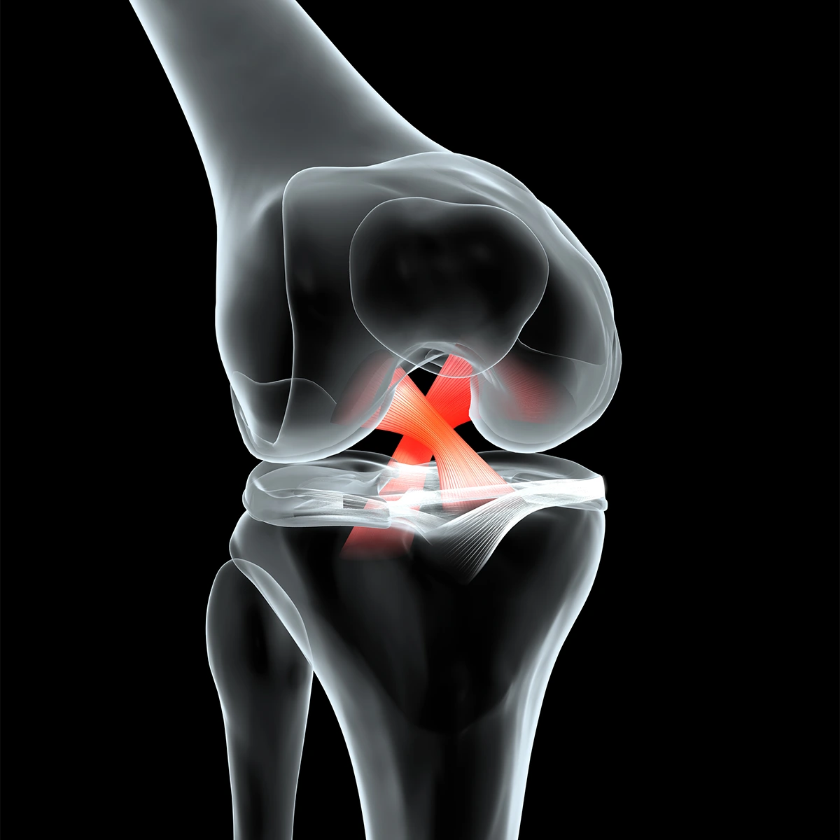 Recognizing the Signs: ACL Injury in Dogs