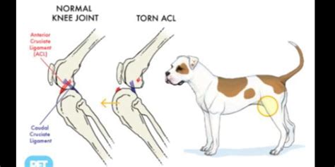 5 Essential Tips for ACL Repair Costs