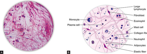 Areolar Connective Tissue Labeled Mast Cells Areolar Connective Tissue Labeled Mast Cells