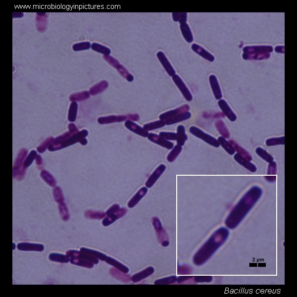 Bacillus Cereus: A Gram Stain Guide
