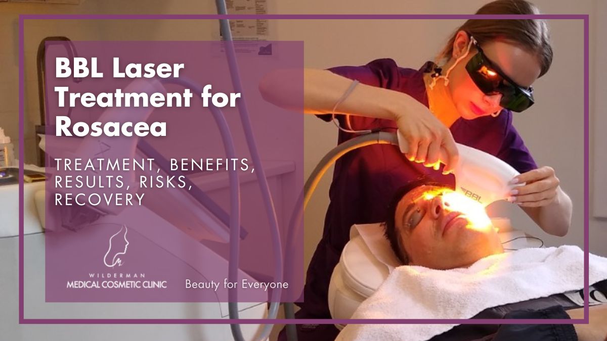 Bbl Laser Treatment Eyes Lids Amp Face Clinic Bbl Laser Treatment Eyes Lids Amp Face Clinic