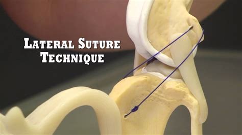 ACL Surgery: Unveiling Treatment Options for Dogs ACL Surgery: Unveiling Treatment Options for Dogs