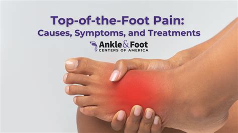 Causes For Foot Pain On Top Of Foot Hotsell Emergencydentistry Com Causes For Foot Pain On Top Of Foot Hotsell Emergencydentistry Com
