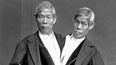 Chang and Eng: A Fascinating Story