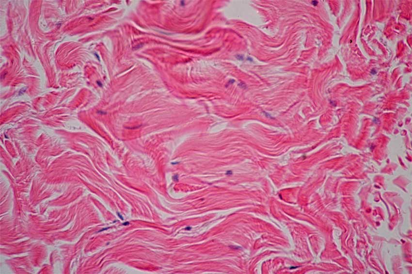 Understanding Dense Irregular Tissue: 5 Key Facts