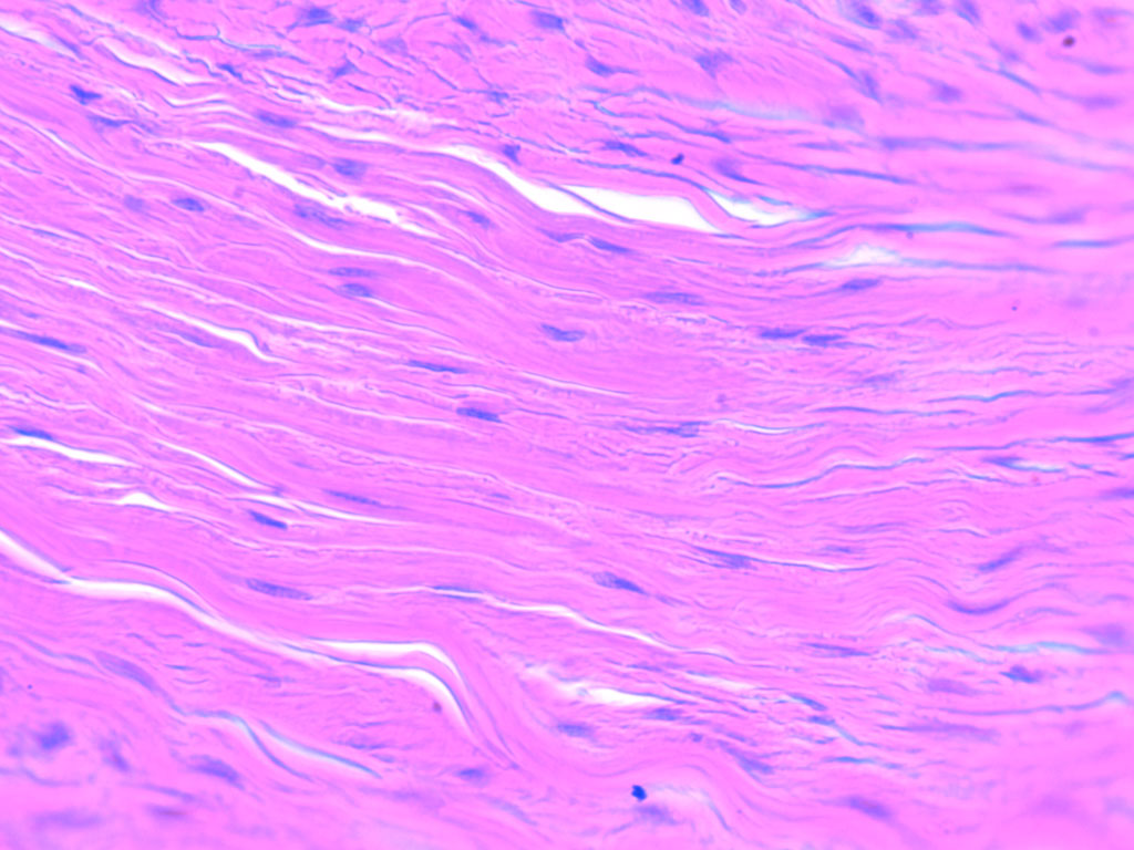 Unraveling Dense Connective Tissue: 3 Key Facts