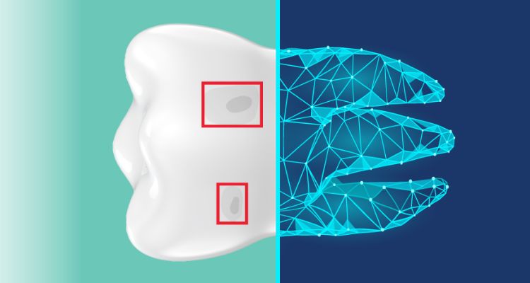 Dentrix Ascend Detect Ai Dentrix Ascend Dentrix Ascend Detect Ai Dentrix Ascend