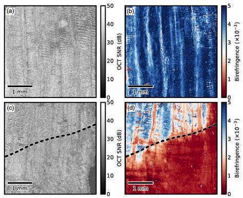 En Face Parametric Imaging Of Tissue Birefringence Using Polarization Sensitive Optical En Face Parametric Imaging Of Tissue Birefringence Using Polarization Sensitive Optical