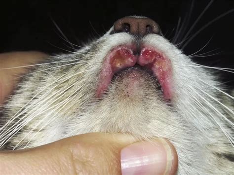 Cat Lip: Uncovering Eosinophilic Granuloma