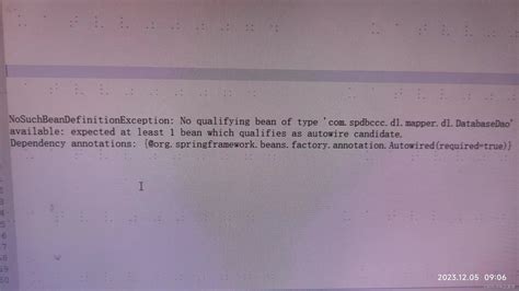 Autowire Candidate: Essential Bean Qualifications