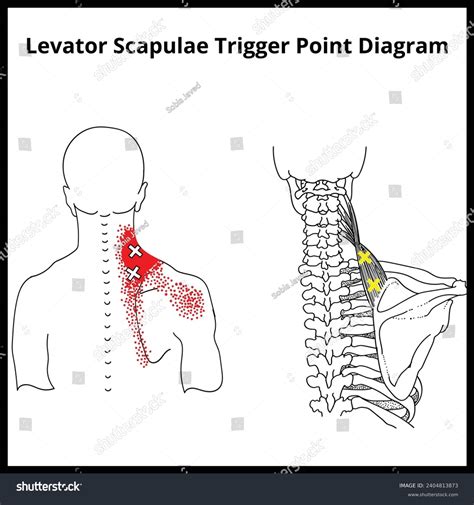 Fotograf A Levator Scapulae Trigger Point Diagram Trigger Point Fotograf A Levator Scapulae Trigger Point Diagram Trigger Point