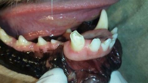 Fractured Left Lower Canine Tooth Teeth Treatment Dental Extraction Fractured Left Lower Canine Tooth Teeth Treatment Dental Extraction