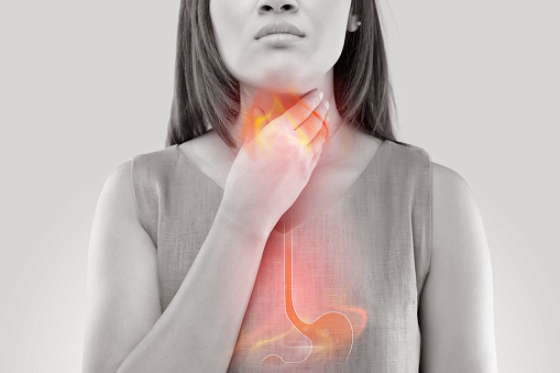 Gastroesophageal Reflux: Understanding the Diagnosis