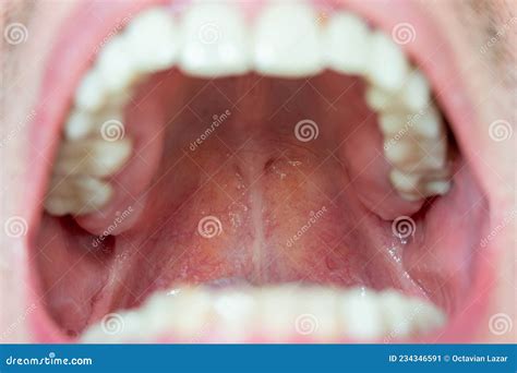 Images: A Healthy Throat Guide