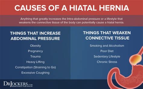 Hiatal Hernia Diagnosis And Treatment Mayo Clinic Hiatal Hernia Diagnosis And Treatment Mayo Clinic