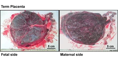 An Insider's Guide to Placenta Sales