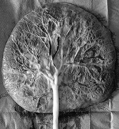 Human Placenta Tree Of Life Human Placenta Tree Of Life