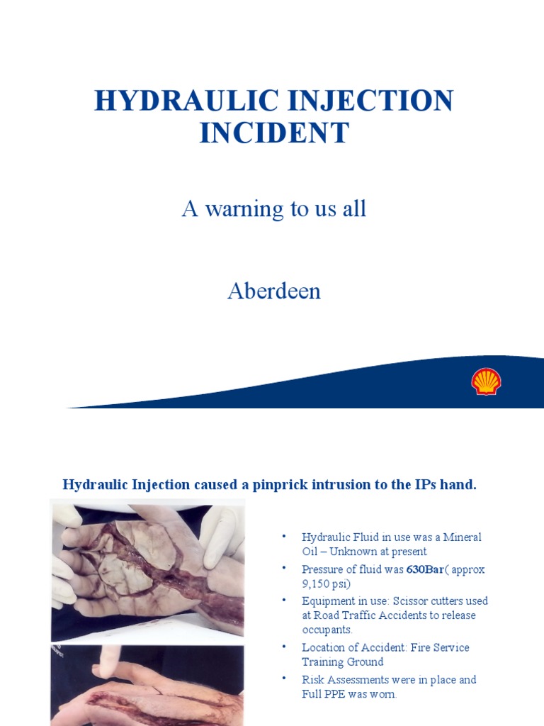 Understanding Hydraulic Fluid Injection: 7 Tips