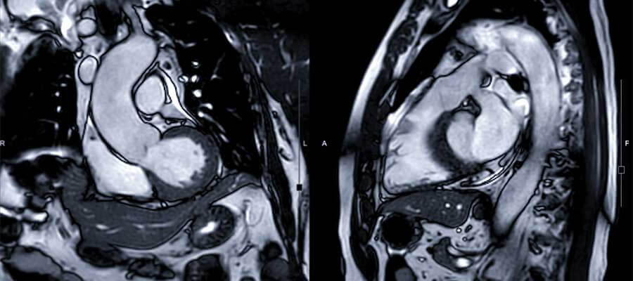Top 5 MRI Tech Schools