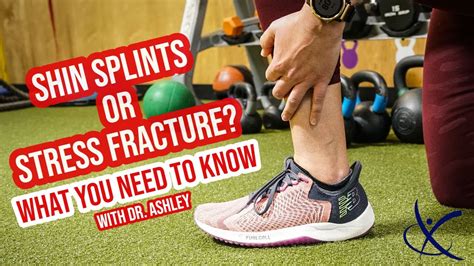 Preventing Shin Splints and Stress Fractures