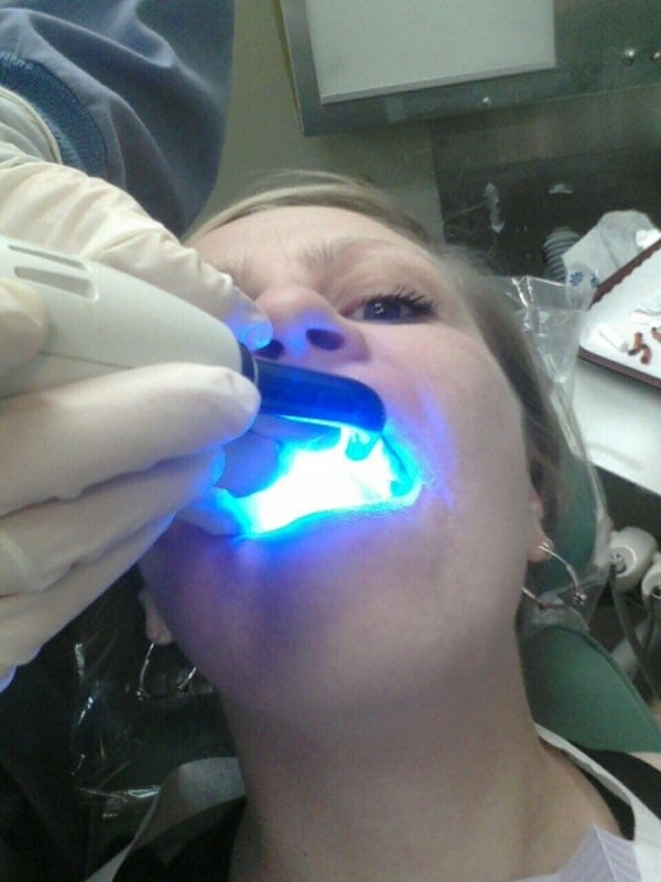 Understanding Sinus Infections and Dental Pain