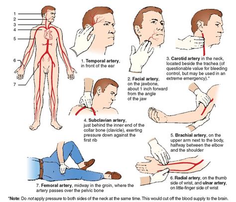 Stop Bleeding By Pinching These Universal Pressure Points First Aid Stop Bleeding By Pinching These Universal Pressure Points First Aid