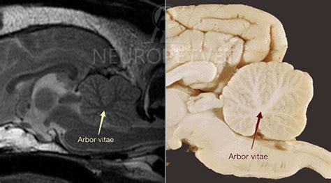 Term Arbor Vitae Neuropetvet Term Arbor Vitae Neuropetvet