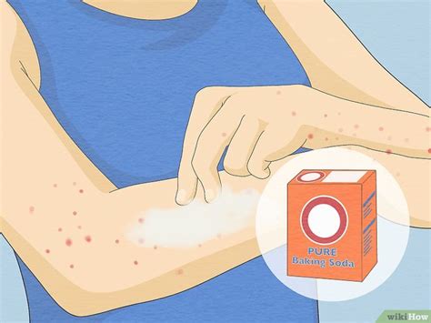 Say Goodbye to Noseeum Bites