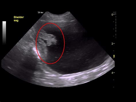 Urinary Bladder Cancer In Dogs Urinary Bladder Cancer In Dogs