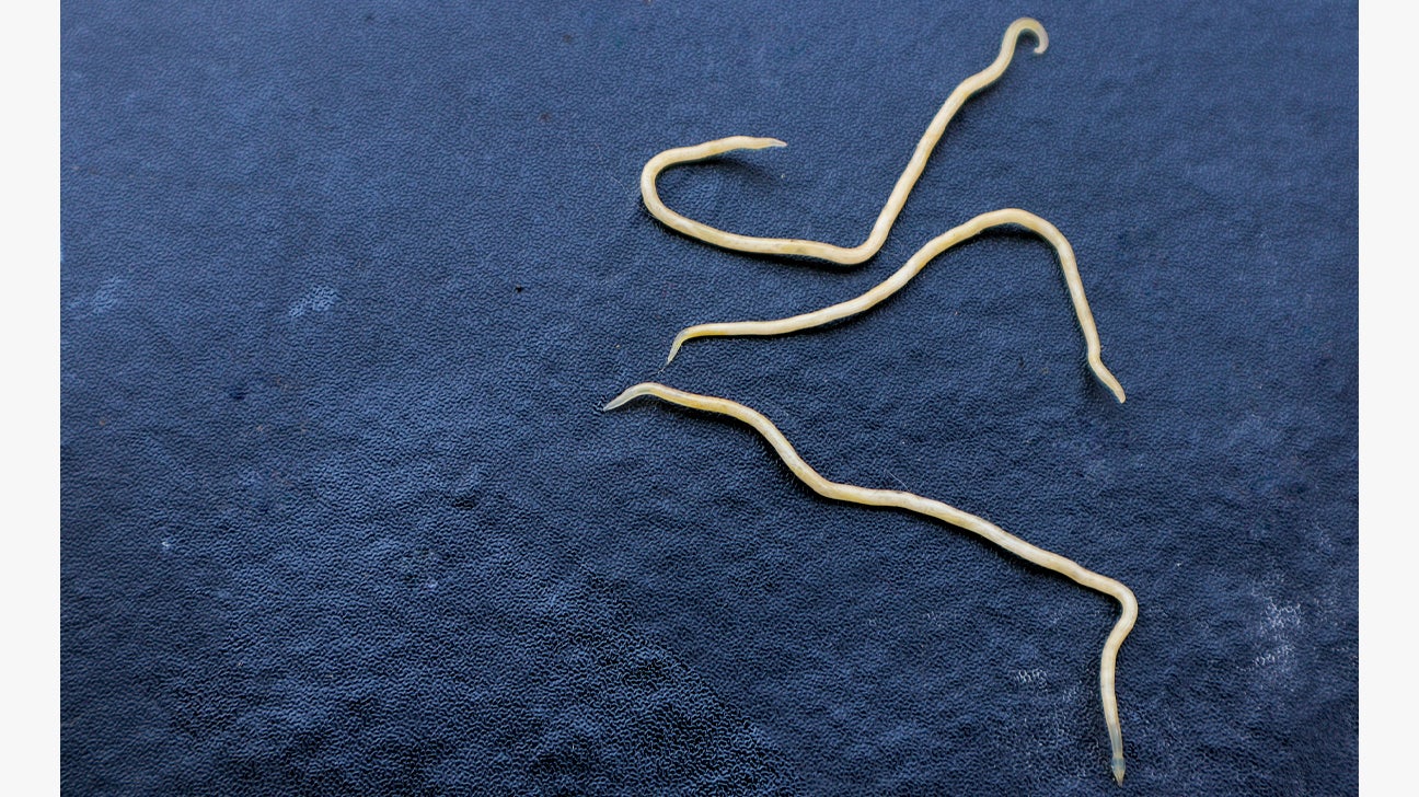 Worms People Can Get Worms People Can Get
