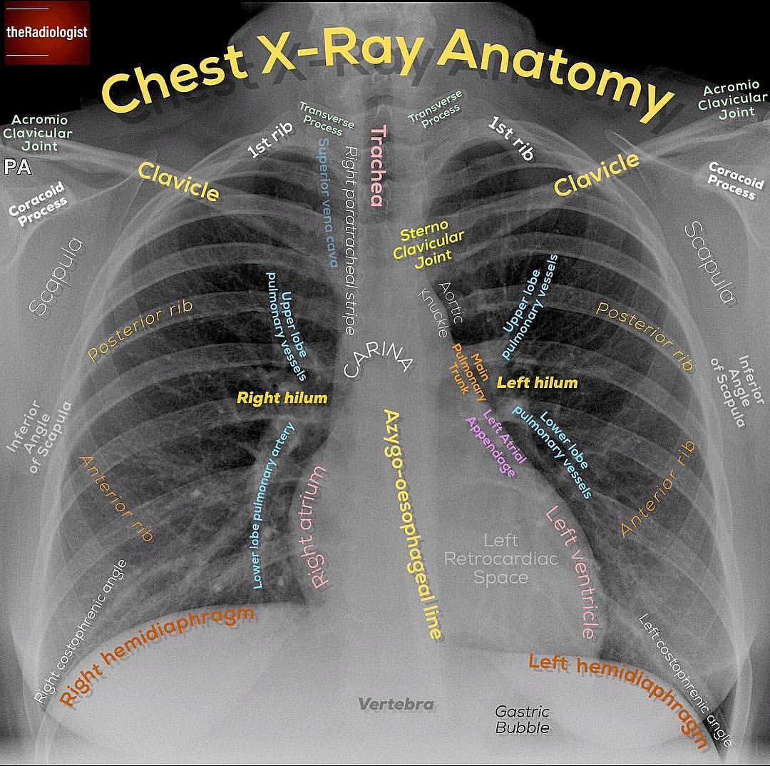 X Ray Chest Anatomy X Ray Chest Anatomy